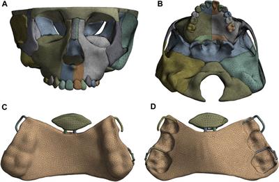 Finite element analysis of sagittal screw expander appliance in the treatment of anterior maxillary hypoplasia